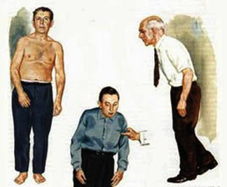 Nel Salento una rete assistenziale per i malati di Parkinson