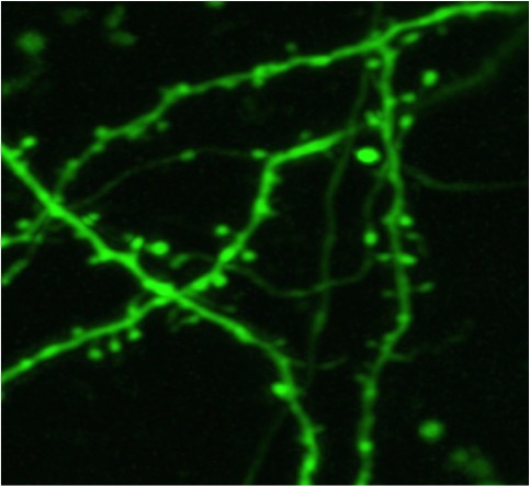 Misurato il cloro in un cervello vivo