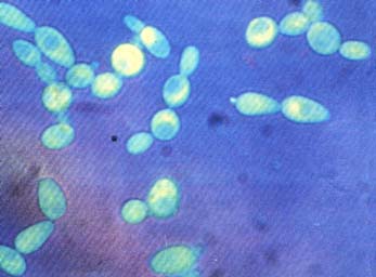 Il lievito di birra e le disfunzioni neurodegenerative Il lievito di birra e le disfunzioni neurodegenerative