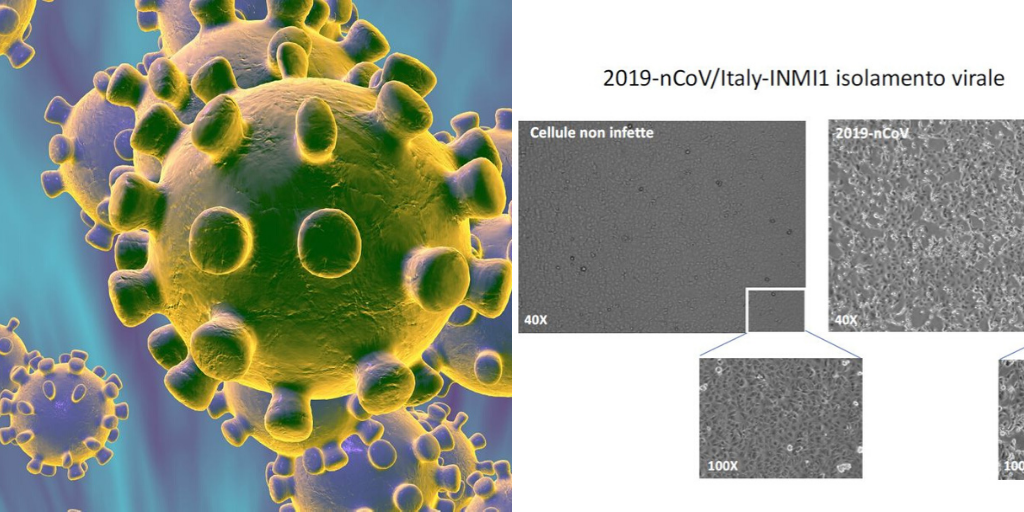 Coronavirus, 19 pazienti sotto osservazione allo Spallanzani Coronavirus, 19 pazienti sotto osservazione allo Spallanzani