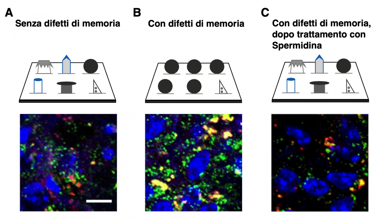 Gli effetti della Spermidina nelle malattie neurodegenerative Gli effetti della Spermidina nelle malattie neurodegenerative