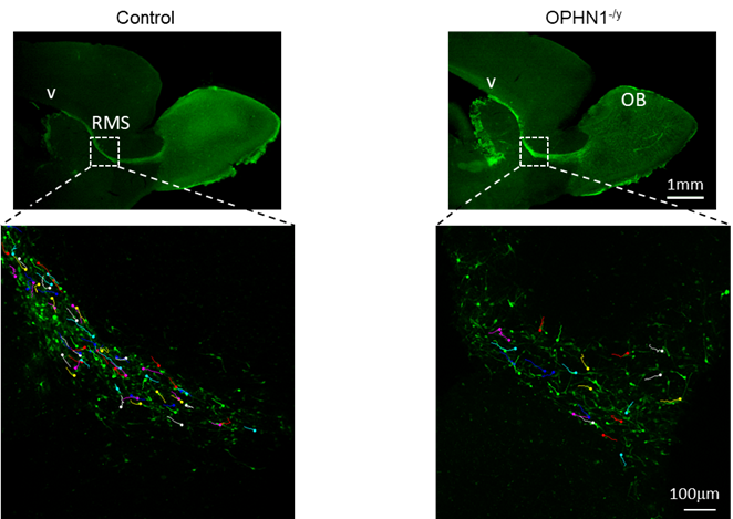 L’effetto della precoce maturazione dei neuroni inibitori sull’insorgenza delle patologie del neurosviluppo L’effetto della precoce maturazione dei neuroni inibitori sull’insorgenza delle patologie del neurosviluppo