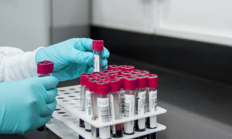 "Vaccinare al più presto i malati oncologici" "Vaccinare al più presto i malati oncologici"