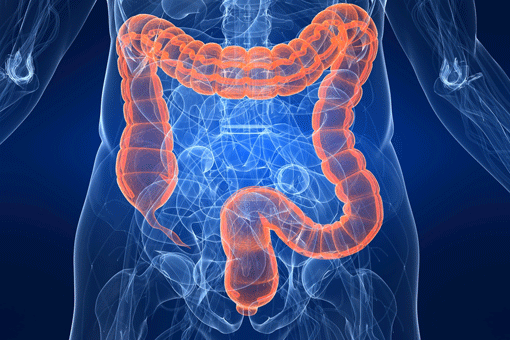 Screening e nuovi farmaci per combattere il tumore al colon-retto