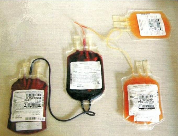 Sacche e trasfusioni validate nell'Asl di Lecce