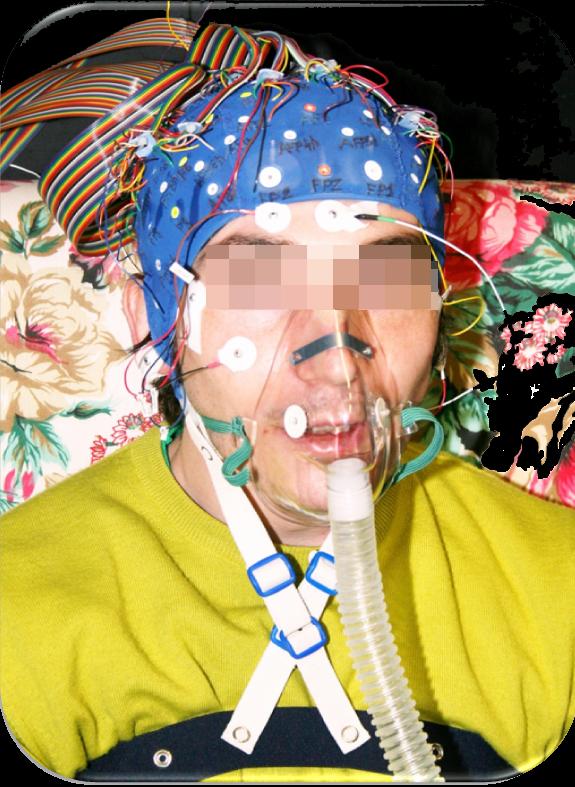 Una minima riduzione di ossigeno al cervello abbassa i livelli di allerta