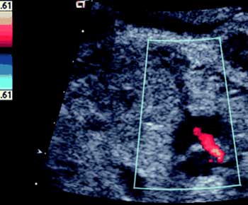 Galatina nella rete dei laboratori di ecografia cardiologica