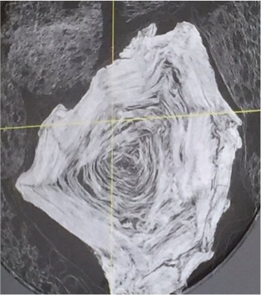 Svelati i segreti dei papiri di Ercolano