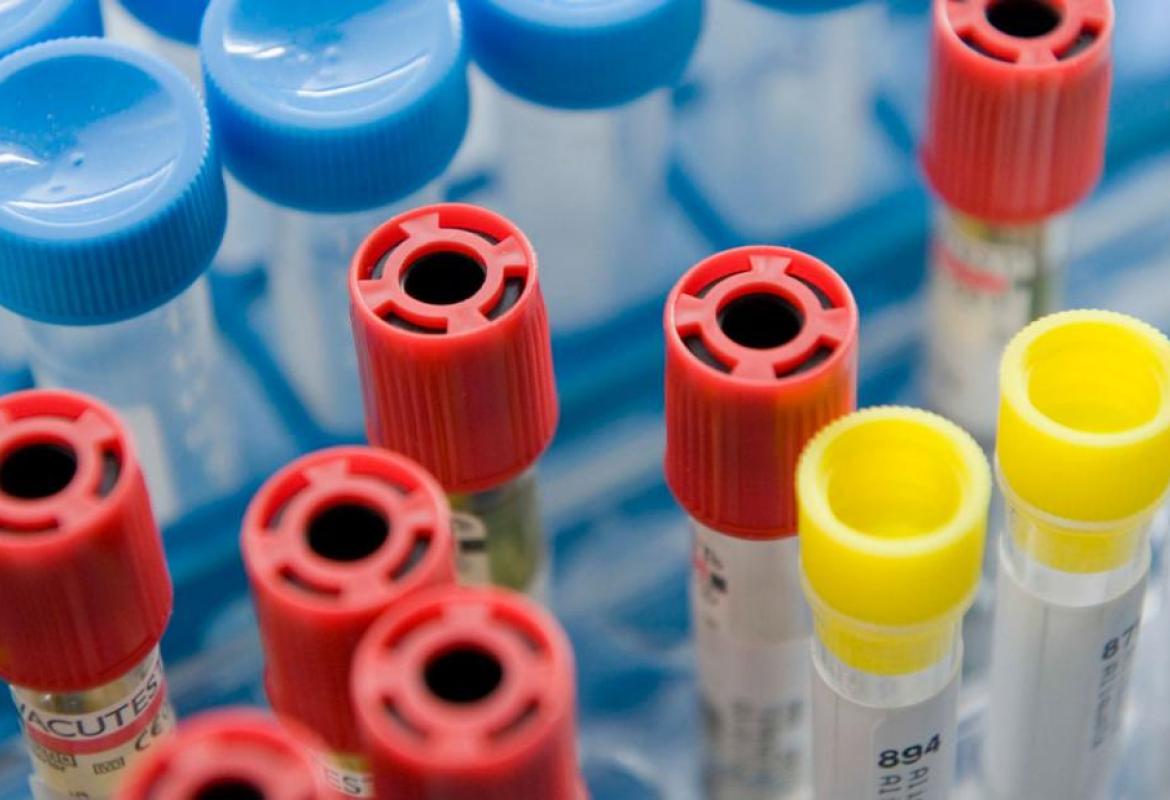 Il Laboratorio di Analisi dell'ospedale di Galatina sospende la sua attività