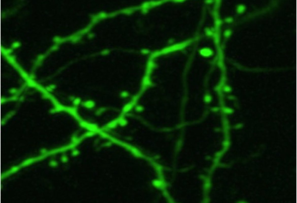 Misurato il cloro in un cervello vivo