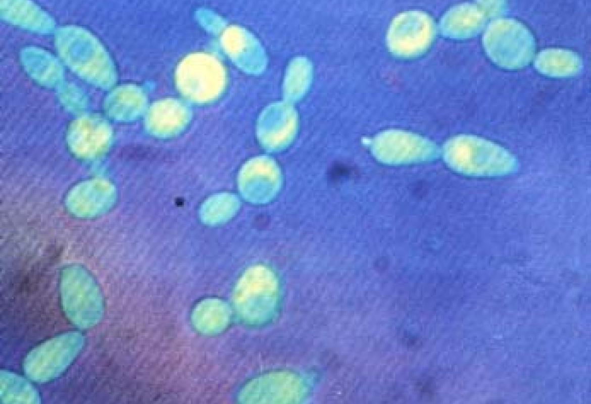 Il lievito di birra e le disfunzioni neurodegenerative