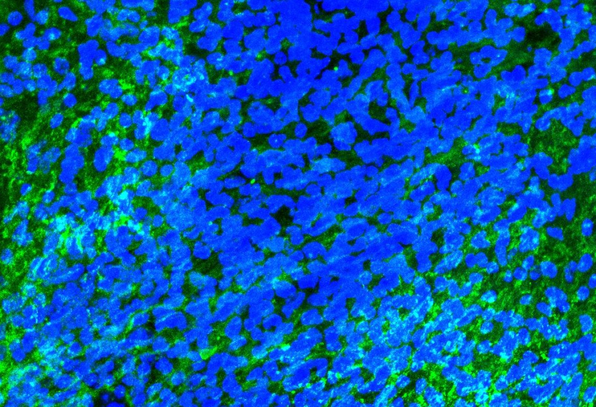 Sclerosi multipla: il ruolo della microglia nella riparazione della mielina