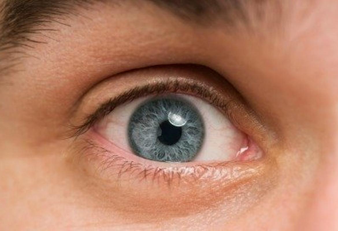 Il diabete è tra le principali cause di cecità al mondo