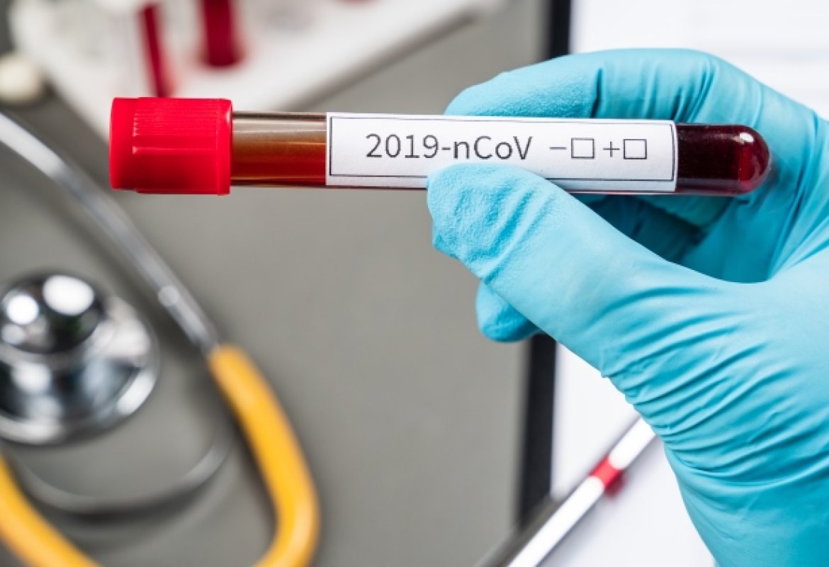 "Garantire tutte le iniziative a tutela della salute di lavoratori ed utenti"