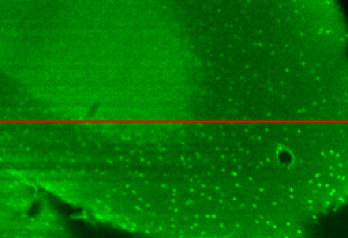 Lenti 'intelligenti' per studiare il cervello al microscopio