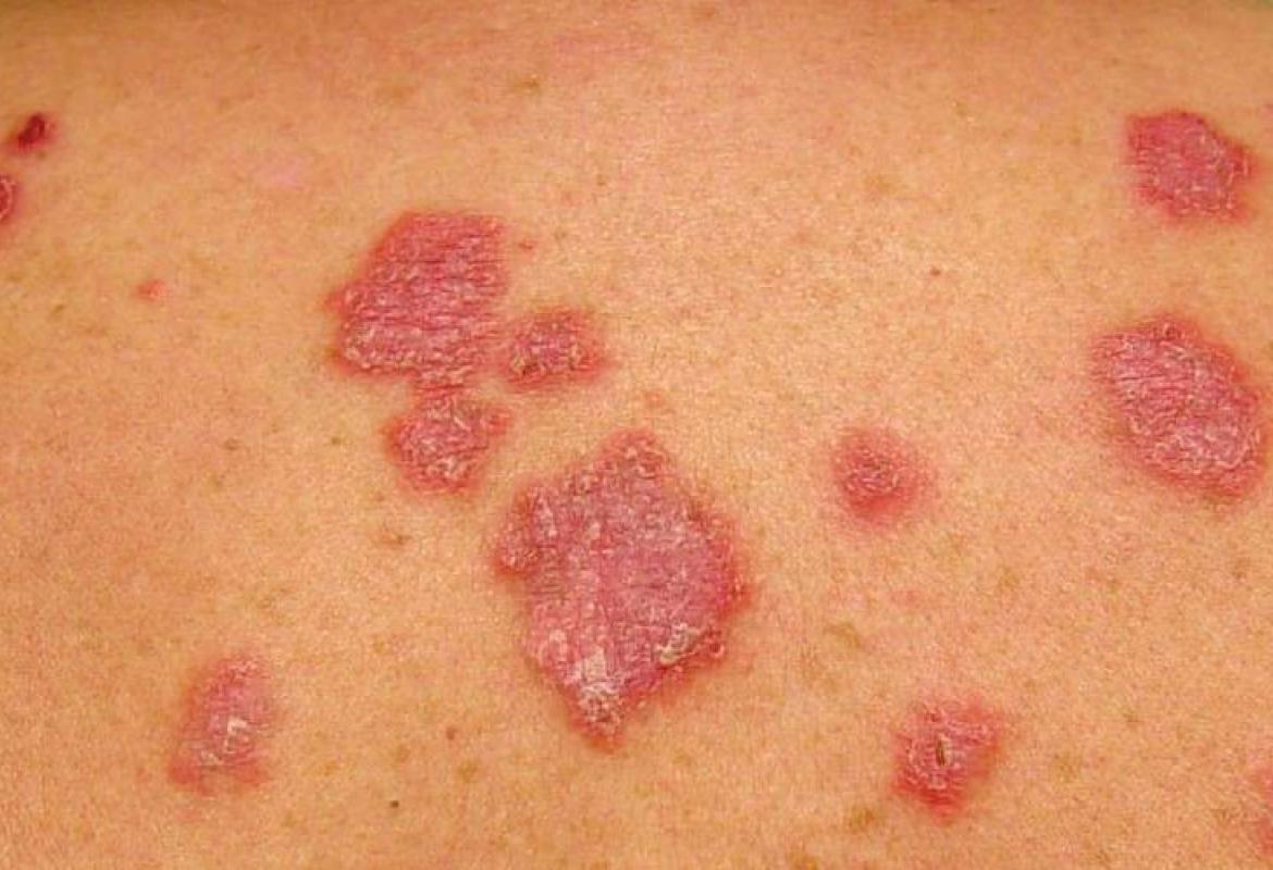 “Dalla parte della tua pelle”