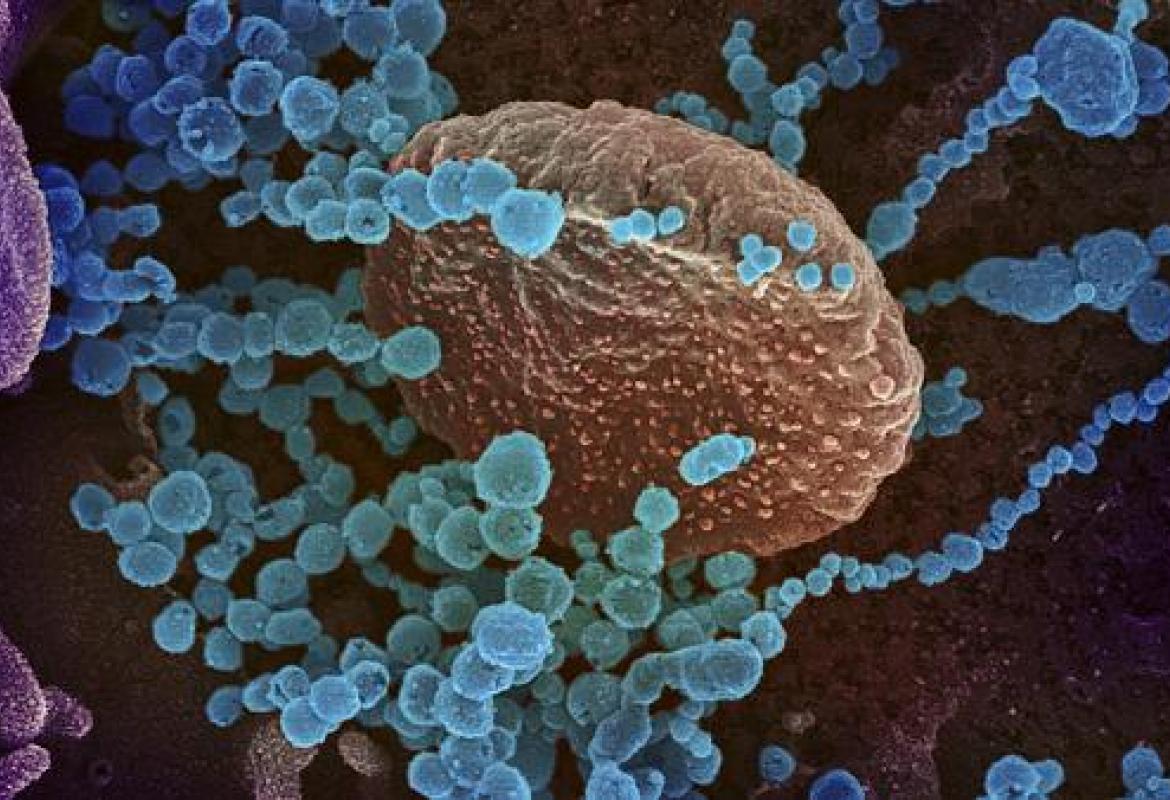 COVID-19. Raddoppiano i nuovi casi nel Salento (39), 772 in Puglia. Chiuse le scuole in tutta la Regione