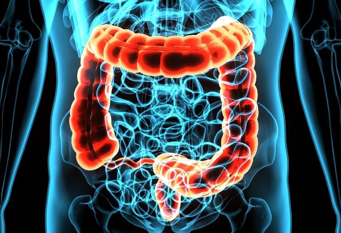 Asl Lecce ha riavviato il programma di screening al colon retto 