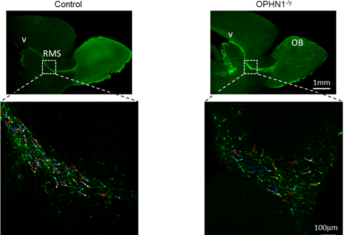 L’effetto della precoce maturazione dei neuroni inibitori sull’insorgenza delle patologie del neurosviluppo