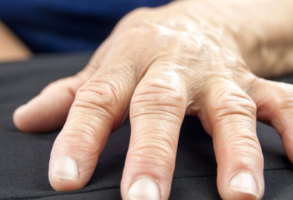 Artriti precoci, presso l'Ospedale di San Cesario l'ambulatorio di Asl Lecce
