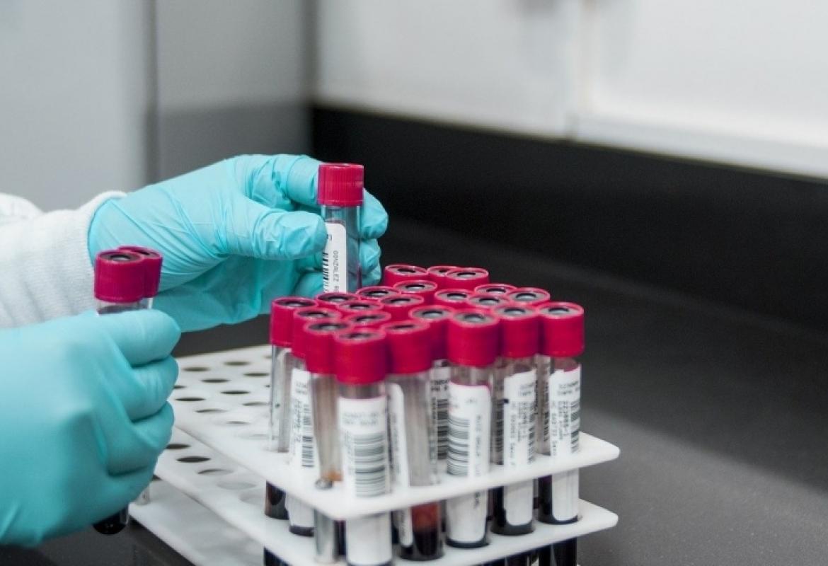 "Vaccinare al più presto i malati oncologici"