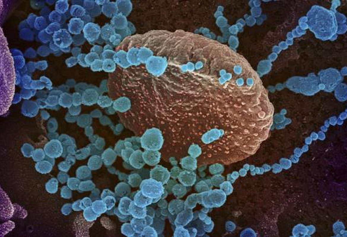 COVID-19. 9 nuovi positivi nel Salento su 15 in Puglia