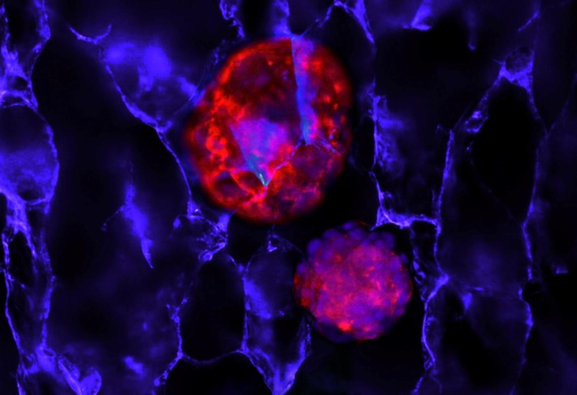 Sviluppato a Lecce un gel che consente di studiare la crescita e lo sviluppo di tessuti tumorali in vitro 