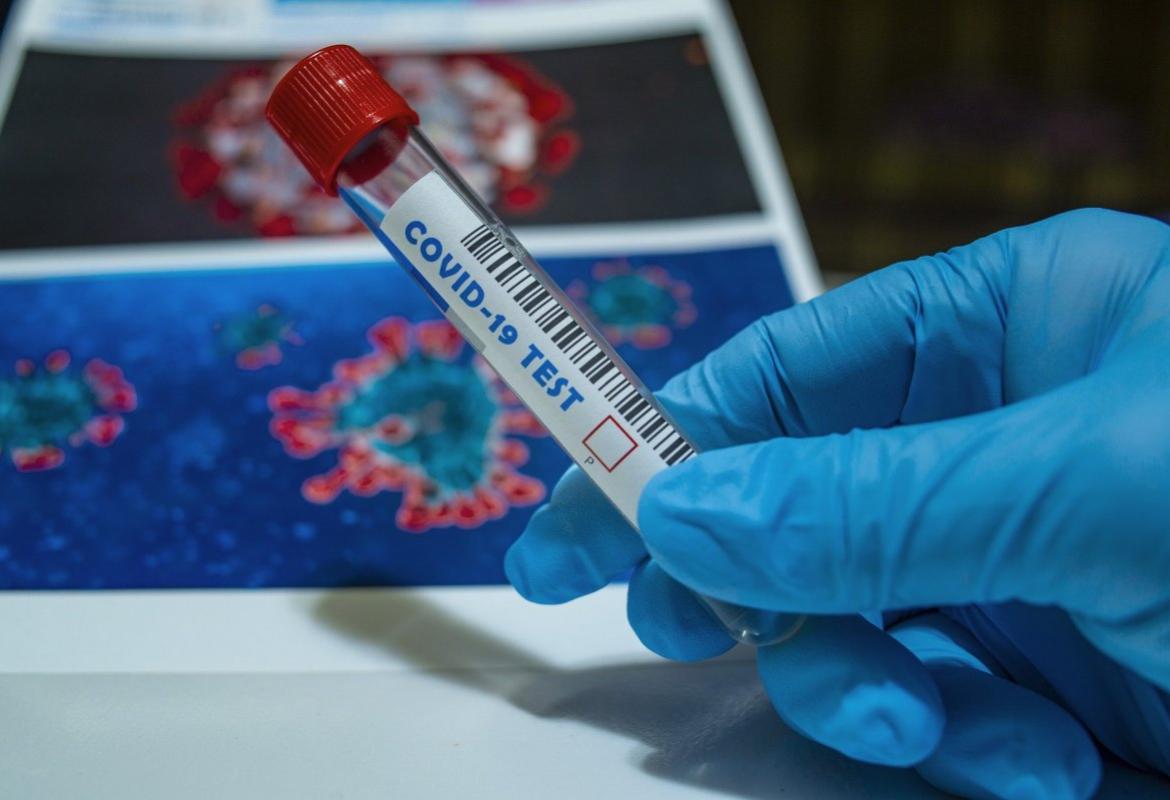 Tamponi molecolari. Negli hub di Lecce e Taurisano si va solo se convocati