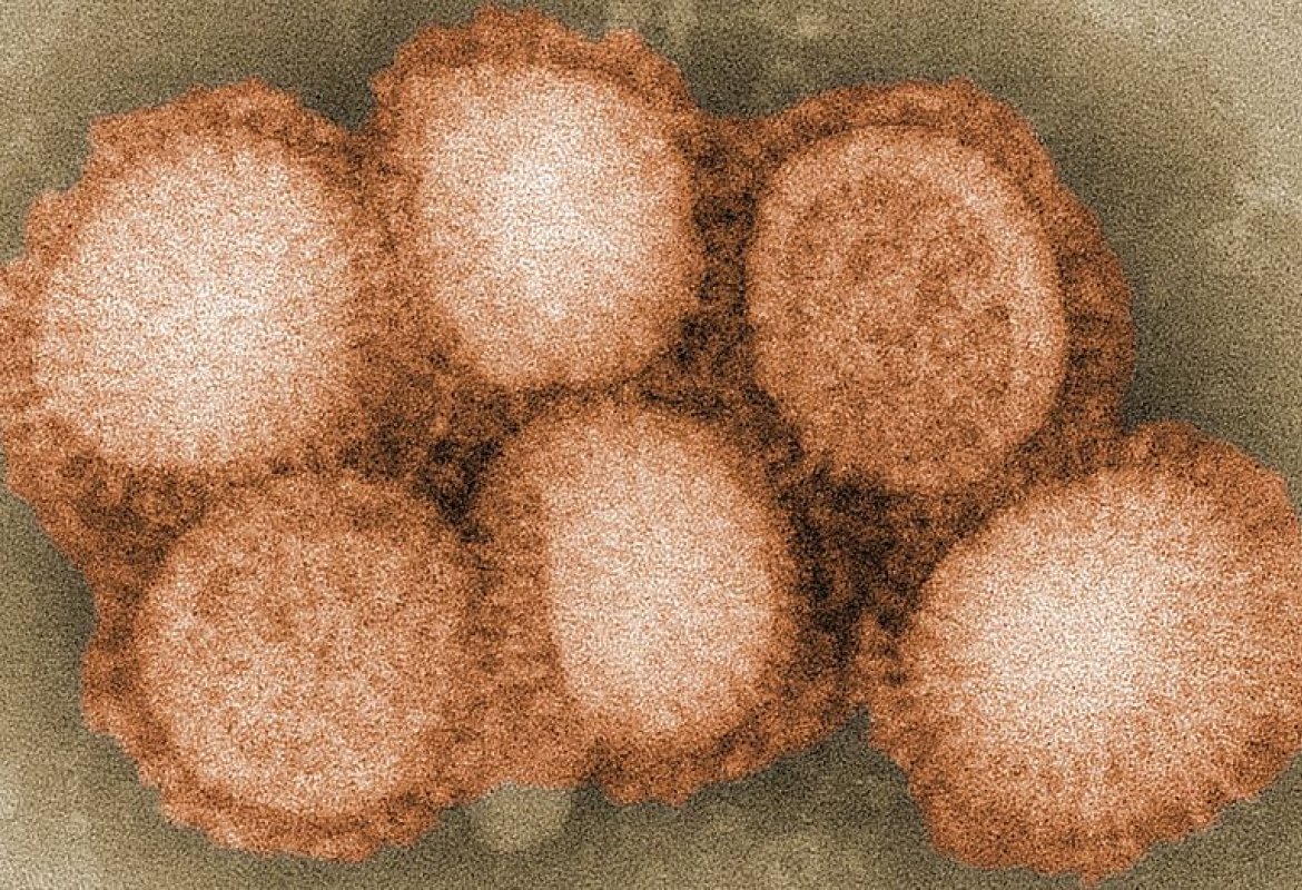 Settima vittima dell'influenza in provincia di Lecce