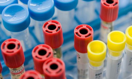 Il Laboratorio di Analisi dell'ospedale di Galatina sospende la sua attività