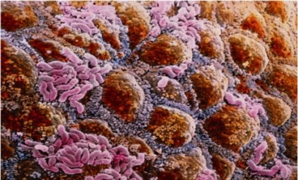 Dalla flora intestinale informazioni sull'autismo