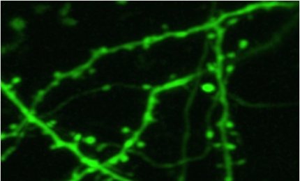 Misurato il cloro in un cervello vivo