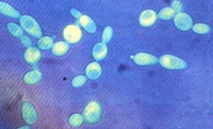 Il lievito di birra e le disfunzioni neurodegenerative