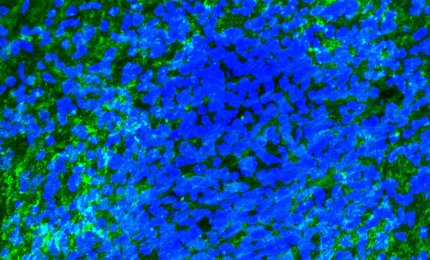 Sclerosi multipla: il ruolo della microglia nella riparazione della mielina