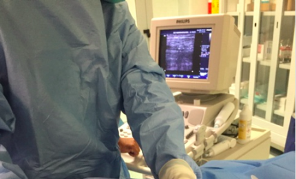 Il piede diabetico curato a Lecce con un autotrapianto di cellule staminali