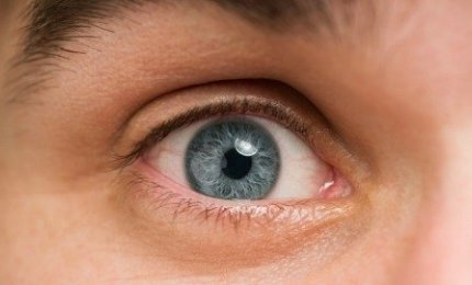 Il diabete è tra le principali cause di cecità al mondo