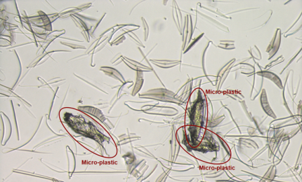 Olografia digitale e intelligenza artificiale per distinguere le microplastiche dal microplankton 