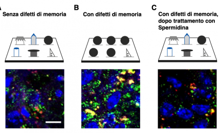 Gli effetti della Spermidina nelle malattie neurodegenerative