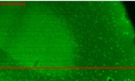 Lenti 'intelligenti' per studiare il cervello al microscopio