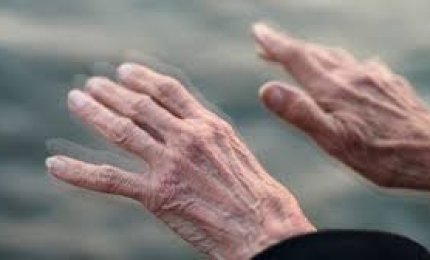 Scoperto un potenziale biomarcatore precoce del Parkinson