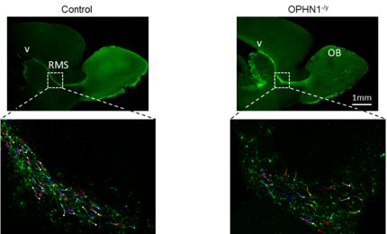L’effetto della precoce maturazione dei neuroni inibitori sull’insorgenza delle patologie del neurosviluppo