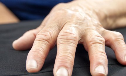 Artriti precoci, presso l'Ospedale di San Cesario l'ambulatorio di Asl Lecce