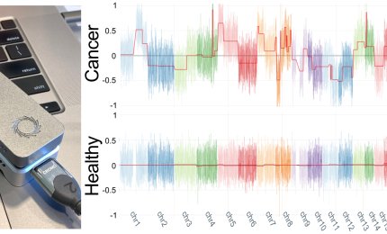 Messo a punto un innovativo metodo per il monitoraggio di pazienti oncologici attraverso un esame del sangue