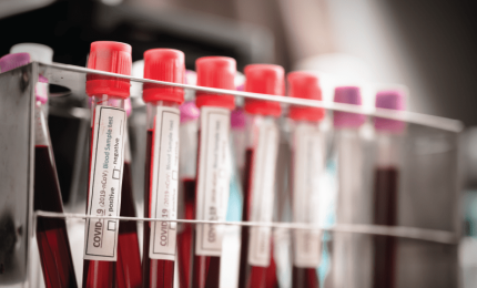 Covid-19. Da una ricerca italiana nuove prospettive per combatterlo