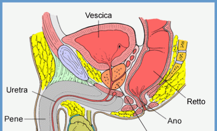 Il tumore alla prostata colpisce di più al nord ma fa più vittime al sud