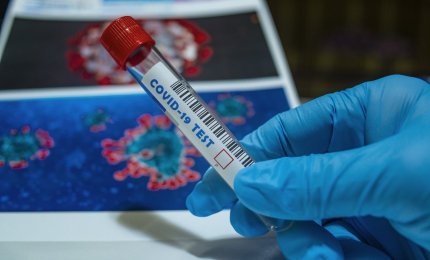 Tamponi molecolari. Negli hub di Lecce e Taurisano si va solo se convocati