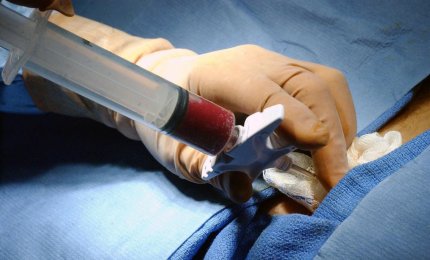 “Ehi tu! Hai midollo?” Giornata della donazione