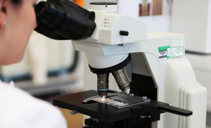 Microscopio e laser per la prevenzione del tumore alla cervice