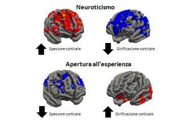 "Dimmi che forma ha il tuo cervello e ti dirò chi sei"