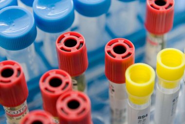 Il Laboratorio di Analisi dell'ospedale di Galatina sospende la sua attività